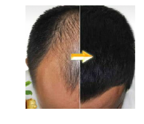 TONICO CRECIMIENTO CAPILAR-FOLICULAR-ORGANICO 30 ml REGISTRO SANITARIO: CS-CR-25-02966